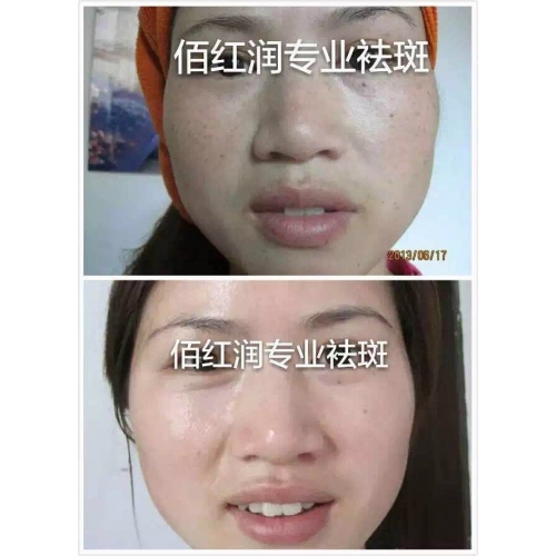 前后對(duì)比照